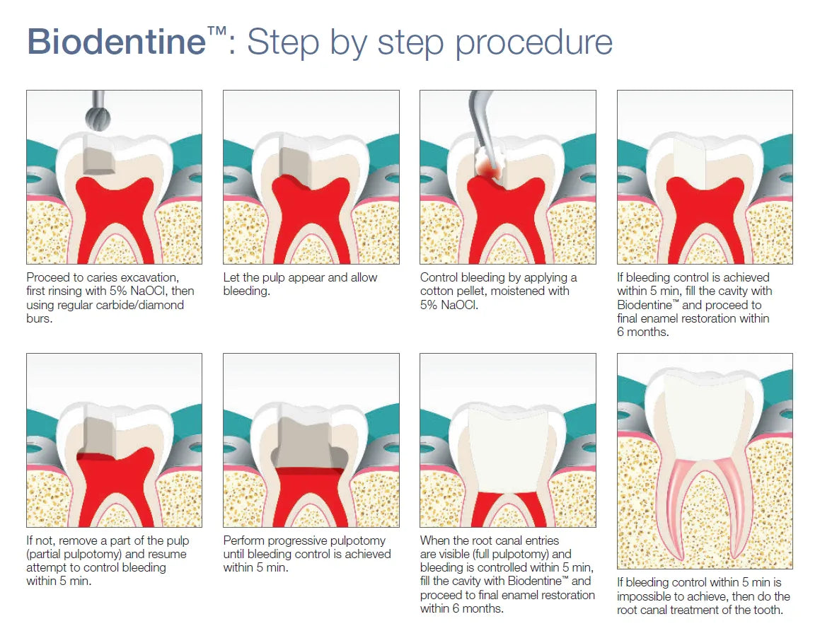 Septodont Biodentine (Single Pouch)